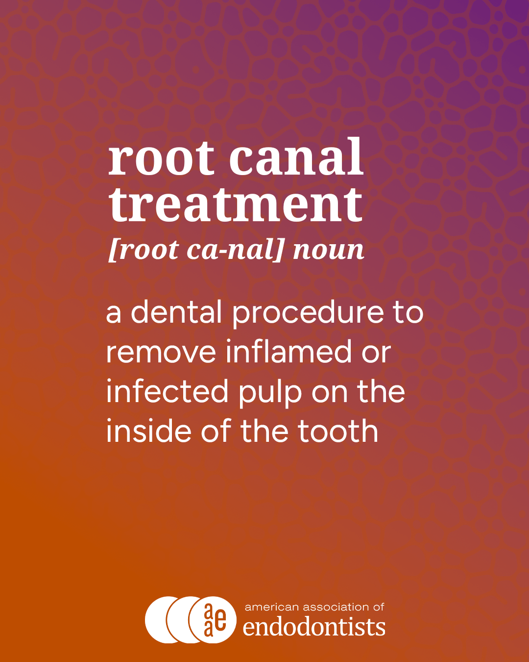 root canal def